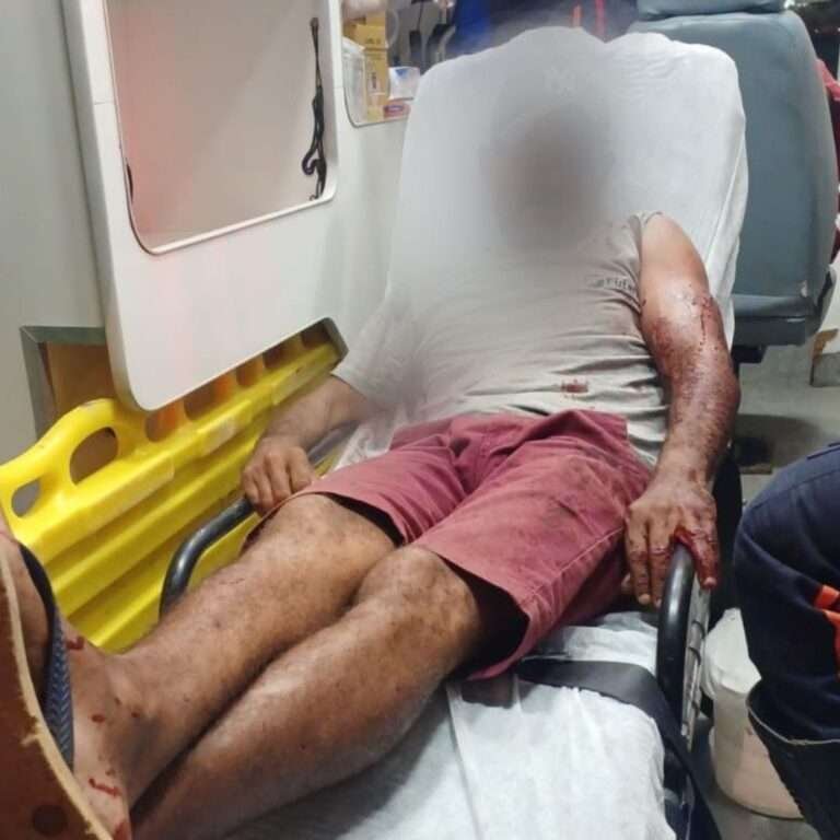 aposta-entre-tio-e-sobrinho-quase-termina-em-morte-em-serra-talhada