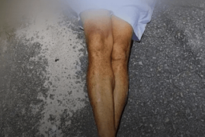 homem-e-executado-a-tiros-na-zona-oeste-do-recife