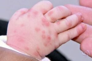 belmonte:-mae-abandona-bebe-em-formigueiro