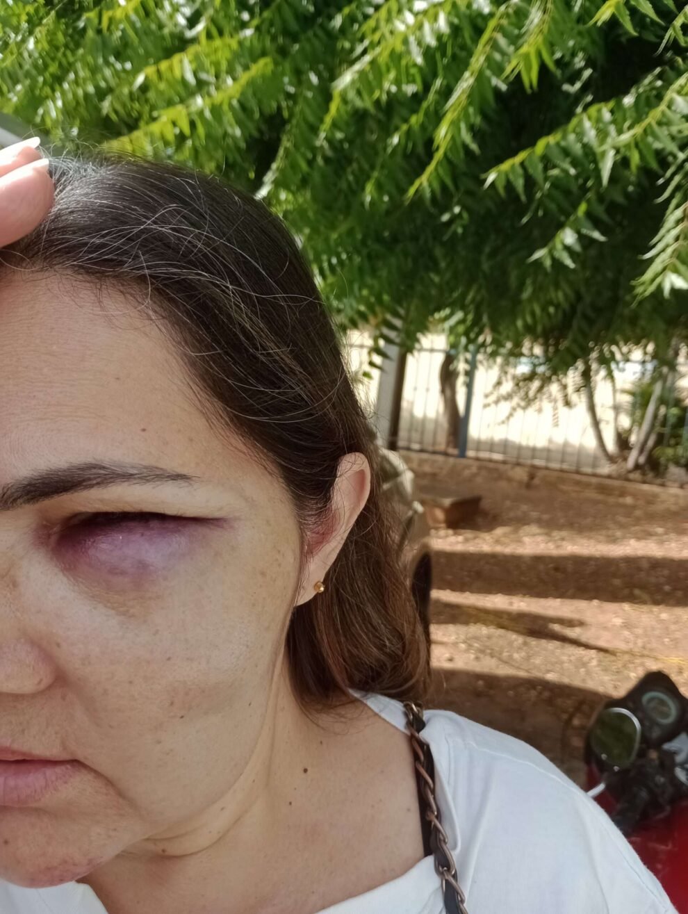 acidente-na-manha-deste-sabado-(15),-no-centro-de-afogados-da-ingazeira