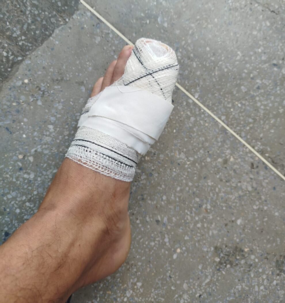 trabalhador-vive-momentos-de-agonia-durante-ataque-de-caes-em-st