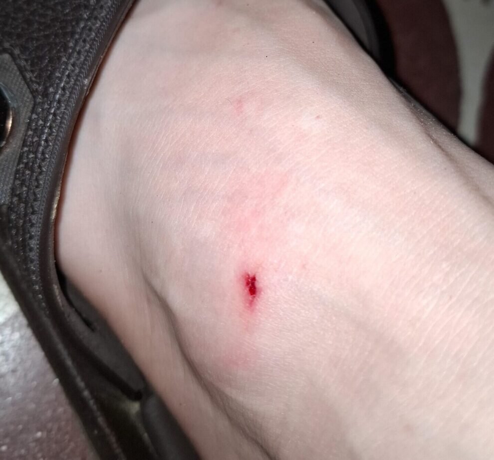 serra-talhadense-denuncia-novo-ataque-de-animais-da-‘patrulha-canina’