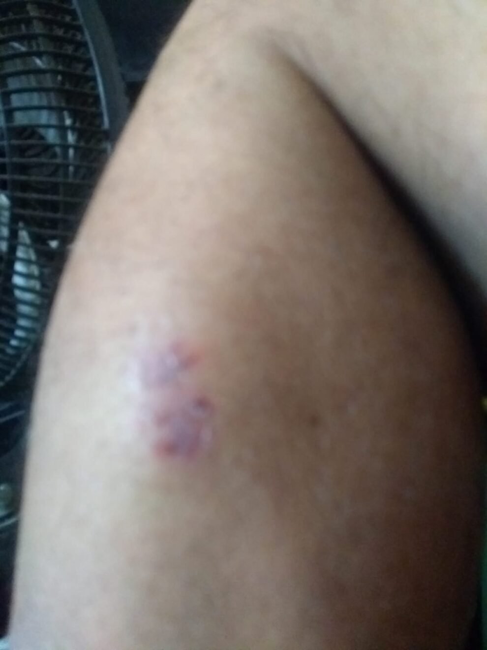 pastor-sofre-ataque-de-cachorros-quando-estava-com-neta-em-st