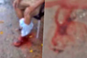 idoso-e-atacado-por-pitbull-ao-tentar-proteger-seu-cao-na-zona-oeste-do-recife