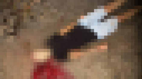 jovem-de-19-anos-e-morto-a-tiros-apos-ser-sequestrado-na-zona-norte-do-recife