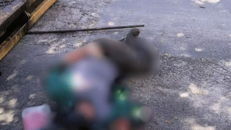 recife:-trabalhador-perde-braco-e-pernas-apos-grave-acidente-com-rampa-de-caminhao