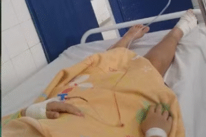 menina-de-8-anos-tem-dedo-amputado-apos-acidente-em-brinquedo-de-praca-no-ibura,-no-recife