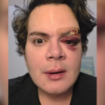 medico-agredido-por-vizinho-em-rosarinho-vive-sob-medo-apos-agressao-homofobica