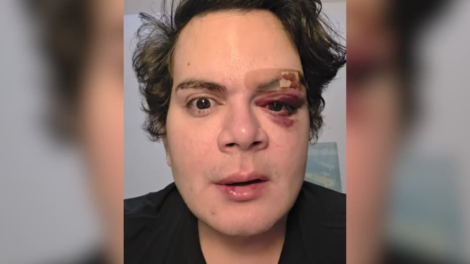 medico-agredido-por-vizinho-em-rosarinho-vive-sob-medo-apos-agressao-homofobica